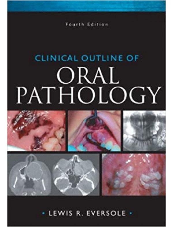 Clinical Outline of Oral Pathology (4th Edition)