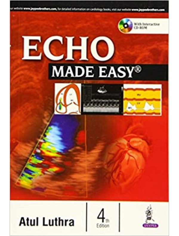 ECHO Made Easy (4th Edition)