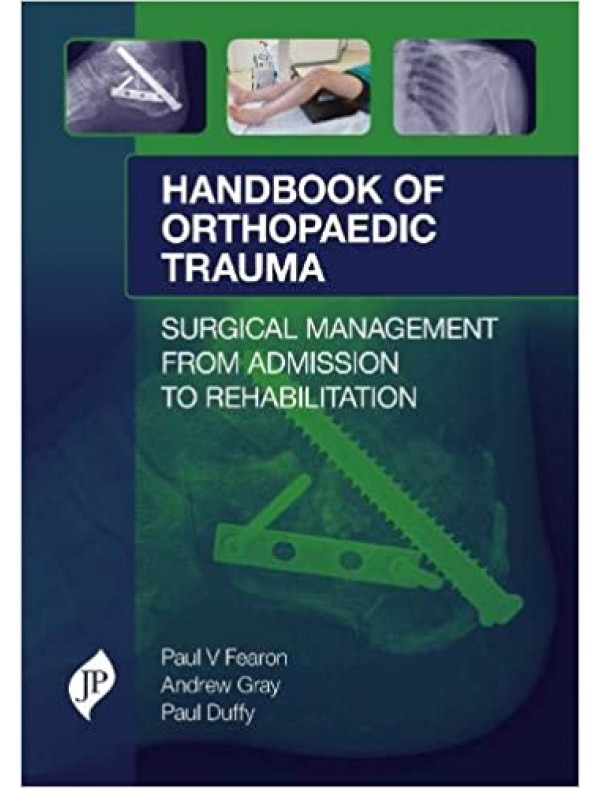 Handbook of Orthopaedic Trauma