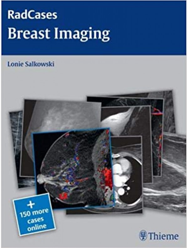 RadCases Breast Imaging