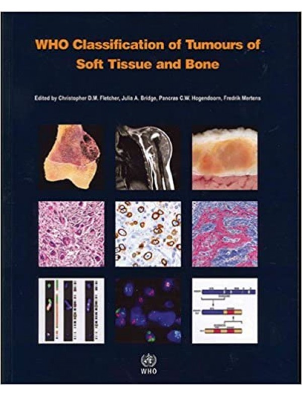 WHO Classification of Tumours of Soft Tissue and Bone (4th Edition)